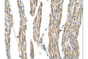 Image no. 1 for anti-Alanine Aminotransferase (ALT) (AA 31-80) antibody (ABIN320978) (ALT Antikörper  (AA 31-80))