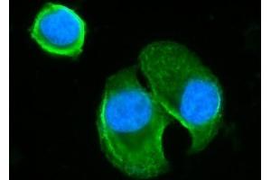 IF analysis of BLNK using anti-BLNK antibody (ABIN7602100). (B-Cell Linker Antikörper  (AA 59-456))