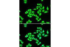 Immunofluorescence analysis of U2OS cells using TPD52L1 antibody (ABIN5973820).