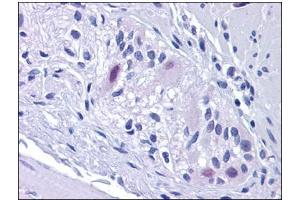 Human Colon, Myenteric Plexus: Formalin-Fixed, Paraffin-Embedded (FFPE) (Retinoblastoma Binding Protein 8 Antikörper)