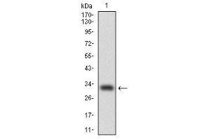 Image no. 1 for anti-CCAAT/enhancer Binding Protein (C/EBP), alpha (CEBPA) antibody (ABIN1497468) (CEBPA Antikörper)