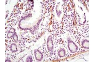 Immunohistochemistry (IHC) image for anti-Lipoma-preferred partner (LPP) antibody (ABIN969263)