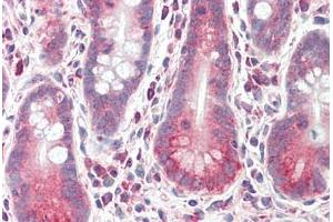 Human Small Intestine: Formalin-Fixed, Paraffin-Embedded (FFPE) (LRRK1 Antikörper  (AA 474-523))
