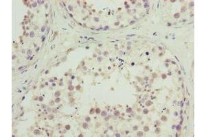 Immunohistochemistry of paraffin-embedded human testis tissue using ABIN7174711 at dilution of 1:100 (TMEM234 Antikörper  (AA 1-145))