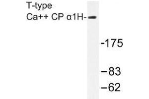Image no. 1 for anti-Calcium Channel, Voltage-Dependent, T Type, alpha 1H Subunit (CACNA1H) antibody (ABIN317940) (CACNA1H Antikörper)