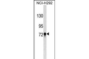 TGM3 Antibody (C-term) (ABIN1537448 and ABIN2849136) western blot analysis in NCI- cell line lysates (35 μg/lane). (TGM3 Antikörper  (C-Term))