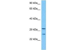 Host:  Mouse  Target Name:  TAL1  Sample Tissue:  Mouse Kidney  Antibody Dilution:  1ug/ml (TAL1 Antikörper  (Middle Region))