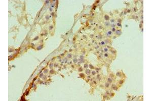 Immunohistochemistry of paraffin-embedded human testis tissue using ABIN7171013 at dilution of 1:100