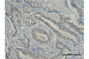 Immunohistochemistry (IHC) image for anti-Tumor Necrosis Factor Receptor Superfamily, Member 6b, Decoy (TNFRSF6B) antibody (ABIN2664922)