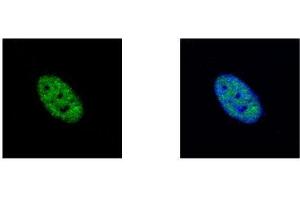 ICC/IF Image NEK4 antibody [N2C1], Internal detects NEK4 protein at nucleus by confocal immunofluorescent analysis.