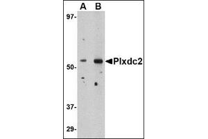 Western blot analysis of Plxdc2 in human brain tissue lysate with this product at (A) 0. (PLXDC2 Antikörper  (N-Term))