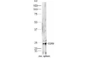 Mouse spleen lysates probed with Rabbit Anti-CD69 Polyclonal Antibody, Unconjugated  at 1:5000 for 90 min at 37˚C. (CD69 Antikörper  (AA 101-199))