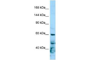Western Blotting (WB) image for anti-RNA Polymerase II Subunit RPB1 (POLR2A) (N-Term) antibody (ABIN2788998) (POLR2A/RPB1 Antikörper  (N-Term))