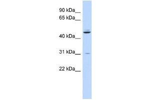 WB Suggested Anti-ZNF238 Antibody Titration:  0. (ZNF238 Antikörper  (N-Term))