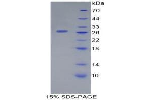 SDS-PAGE (SDS) image for Lectin, Galactoside-Binding, Soluble, 12 (LGALS12) (AA 70-291) protein (His tag) (ABIN1877169)