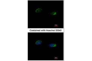 ICC/IF Image Immunofluorescence analysis of methanol-fixed HeLa, using Homer, antibody at 1:500 dilution. (HOMER1 Antikörper  (Center))