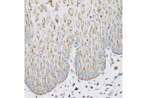 Immunohistochemistry of paraffin-embedded human esophagus using IGF2BP3 antibody (ABIN5972501) at dilution of 1/200 (40x lens). (IGF2BP3 Antikörper)