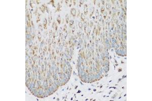Immunohistochemistry of paraffin-embedded human esophagus using IGF2BP3 antibody (ABIN5972501) at dilution of 1/200 (40x lens).