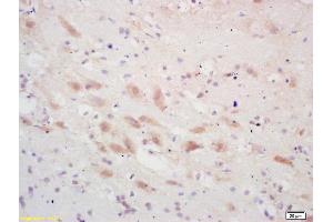 Formalin-fixed and paraffin embedded rat brain labeled with Rabbit Anti PSCA Polyclonal Antibody, Unconjugated (ABIN671676) at 1:200 followed by conjugation to the secondary antibody and DAB staining (PSCA Antikörper  (AA 24-123))