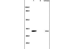 SDS-PAGE (SDS) image for anti-Tumor Necrosis Factor Receptor Superfamily, Member 13B (TNFRSF13B) (AA 21-120) antibody (ABIN680488)