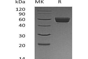 Western Blotting (WB) image for Serine (Or Cysteine) Peptidase Inhibitor, Clade A, Member 3N (SERPINA3N) protein (His tag) (ABIN7320776) (SERPINA3N Protein (His tag))