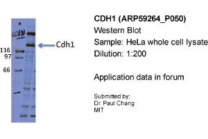Western Blotting (WB) image for anti-Cadherin 1, Type 1, E-Cadherin (Epithelial) (CDH1) (Middle Region) antibody (ABIN2787999)