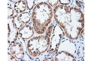 Immunohistochemical staining of paraffin-embedded Carcinoma of prostate tissue using anti-APP mouse monoclonal antibody. (APP Antikörper)