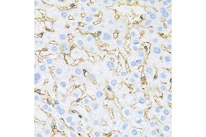 Immunohistochemistry of paraffin-embedded mouse liver using INSR antibody (ABIN5970115) at dilution of 1/100 (40x lens).