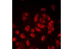 Immunofluorescent analysis of LITAF staining in HepG2 cells. (LITAF Antikörper)