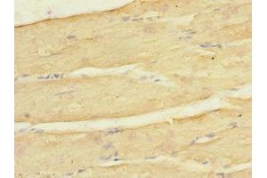 Immunohistochemistry of paraffin-embedded human skeletal muscle tissue using ABIN7157020 at dilution of 1:100 (KCNJ4 Antikörper  (AA 316-445))