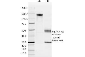 SDS-PAGE Analysis Purified KSP-Cadherin Mouse Monoclonal Antibody (SPM594). (Cadherin-16 Antikörper)