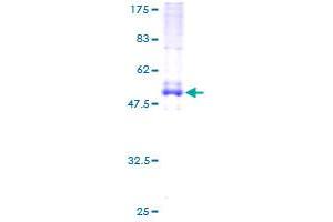 EVI2A Protein (AA 25-236) (GST tag)