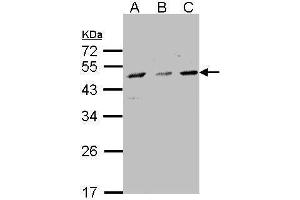 Western Blotting (WB) image for anti-Cytochrome P450, Family 7, Subfamily B, Polypeptide 1 (CYP7B1) (C-Term) antibody (ABIN2855947)