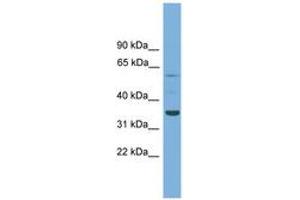 Image no. 1 for anti-Chromosome 3 Open Reading Frame 67 (C3orf67) (AA 71-120) antibody (ABIN6744899) (C3orf67 Antikörper  (AA 71-120))