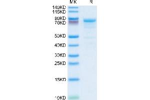 Human KLKB1 on Tris-Bis PAGE under reduced condition. (KLKB1 Protein (AA 20-638) (His tag))