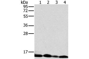 Western Blot analysis of Human liver tissue and K562 cell, Human fetal brain tissue and Raji cell using NDUFS5 Polyclonal Antibody at dilution of 1:400 (NDUFS5 Antikörper)