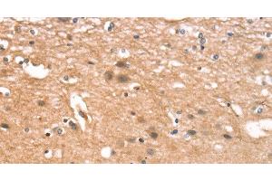 Immunohistochemistry of paraffin-embedded Human brain tissue using CYLD Polyclonal Antibody at dilution 1:35 (CYLD Antikörper)