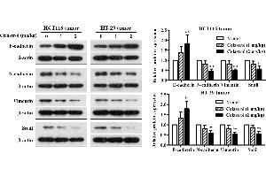 Effects of celastrol on the expression levels of EMT-related proteins in xenograft CRC mice. (SNAI1, SNAI2, SNAI3 (AA 188-264) Antikörper)