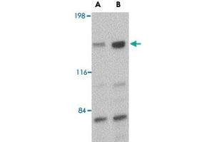 Western blot analysis of CADPS in rat brain tissue lysate with CADPS polyclonal antibody  at (A) 0. (CADPS Antikörper  (C-Term))