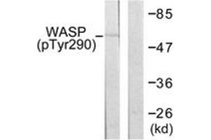 Western blot analysis of extracts from HepG2 cells, using WASP (Phospho-Tyr290) Antibody. (WASP Antikörper  (pTyr290))