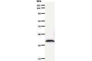 Western Blotting (WB) image for anti-TBP-Associated Factor 172 (BTAF1) antibody (ABIN933089) (BTAF1 Antikörper)