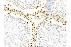 ABIN6261411 and ABIN6266531 at 1/100 staining Rat testis tissue by IHC-P. (E2F4 Antikörper  (N-Term))