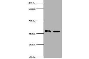 Western blot All lanes: Aldo-keto reductase family 1 member C4 antibody at 7 μg/mL Lane 1: Hela whole cell lysate Lane 2: HepG 2 whole cell lysate Secondary Goat polyclonal to rabbit IgG at 1/10000 dilution Predicted band size: 37 kDa Observed band size: 37 kDa (AKR1C4 Antikörper  (AA 1-323))