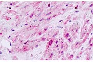 Human, Prostate, smooth muscle: Formalin-Fixed Paraffin-Embedded (FFPE)