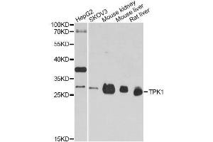 Western blot analysis of extracts of various cell lines, using TPK1 antibody. (TPK1 Antikörper  (AA 1-243))