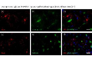 Aged human brain tissue samples of individuals with morphologically dystrophic (a–f) and microglia were stained with an anti-IBA-1 antibody (red: a, d), anti-8-OHdG antibody (green: b, e), and DAPI (blue). (8-OHDG Antikörper)