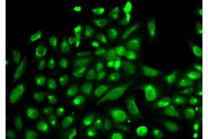 Immunofluorescence analysis of HeLa cell using SPHK1 antibody. (SPHK1 Antikörper  (AA 50-384))