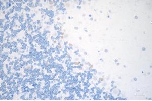 Immunohistochemistry was performed on paraffin-embedded mouse brain using METTL3 antibody (ABIN7799400), 1:200). (Rekombinanter METTL3 Antikörper)