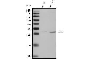 Western blot analysis of Klrd1/CD94 using anti-Klrd1/CD94 antibody (ABIN7601340).