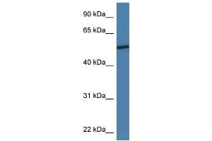 WB Suggested Anti-ADIPOR2 Antibody Titration: 1. (Adiponectin Receptor 2 Antikörper  (N-Term))